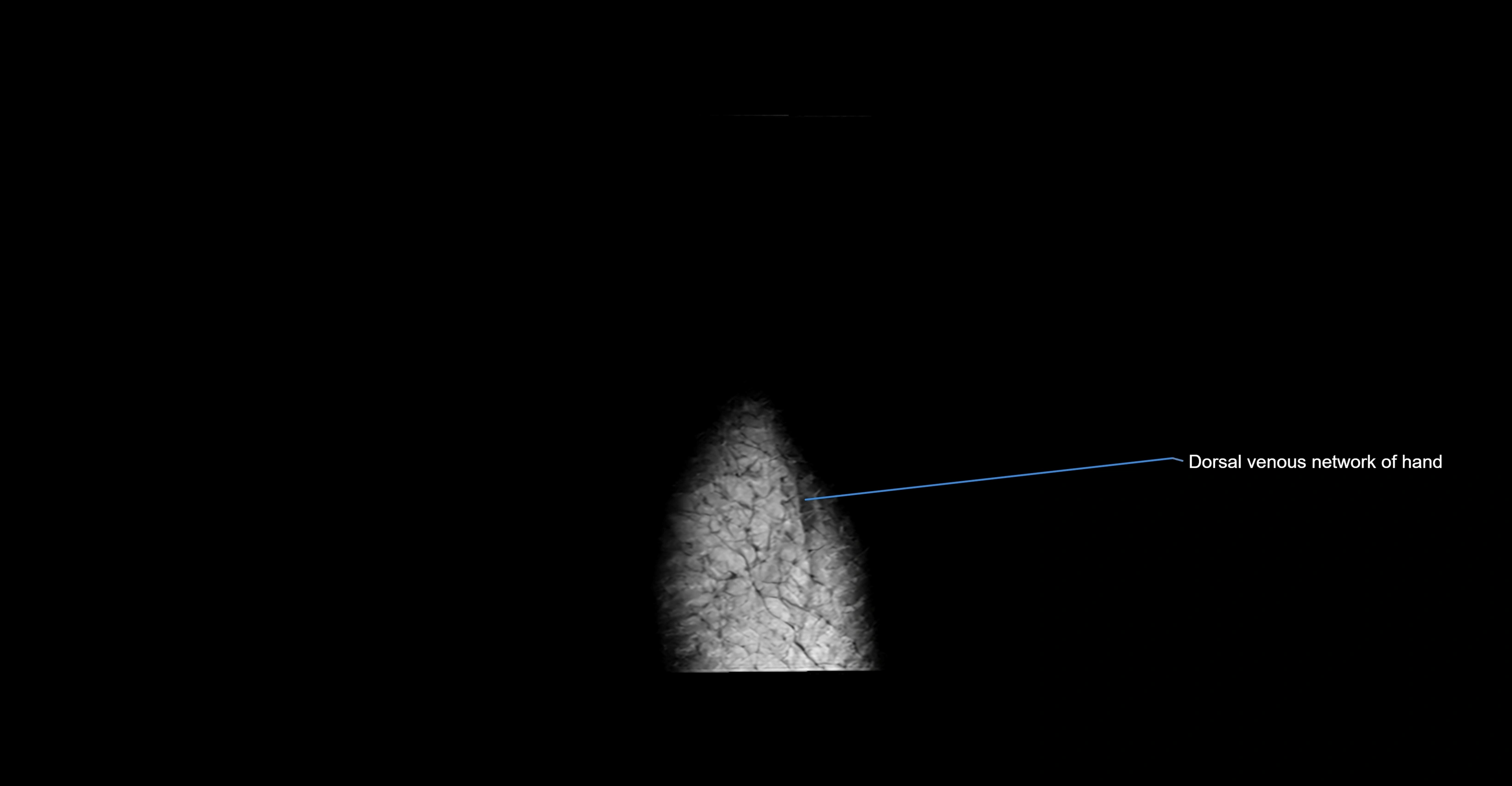 MRI wrist coronal cross sectional anatomy 3T  radiology  image-img-00001-00004.webp